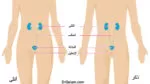 عدوى المسالك البولية